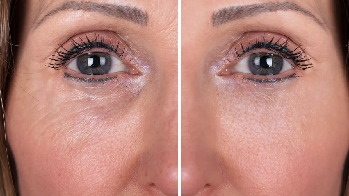 Anti-Aging-Feat-Image