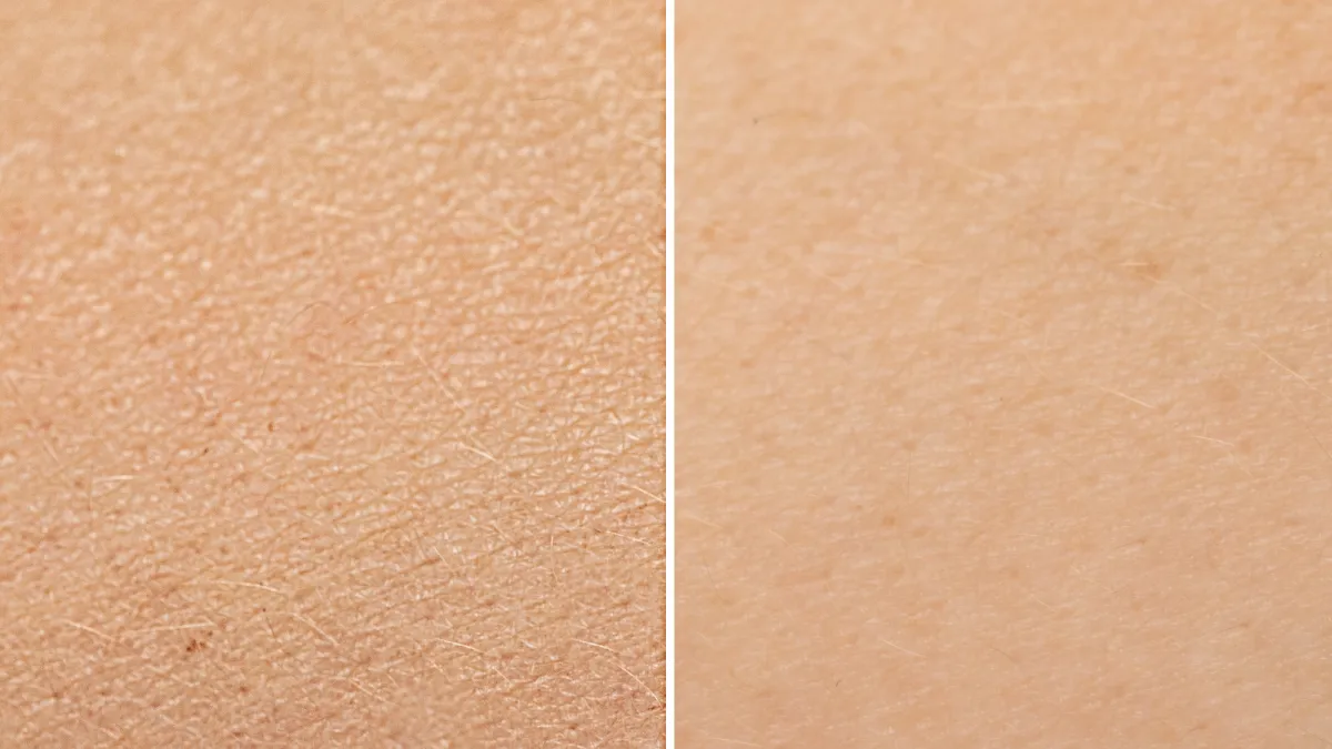 Before-After-Dry-Skin-Stock-Photo