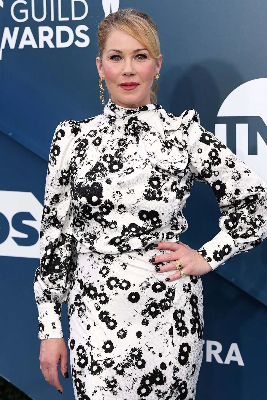 Christina Applegates MS Battle In Her Own Words