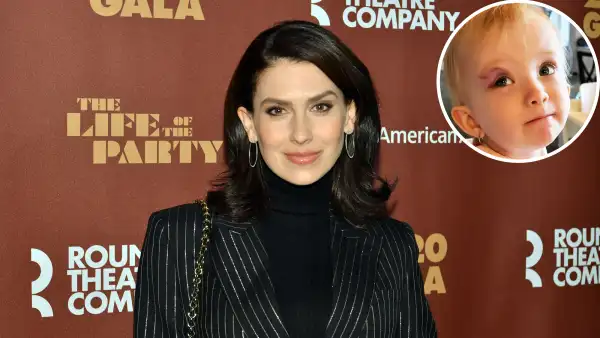 Hilaria Baldwin Reveals Daughter Lucia Suffered Black Eye in Fall