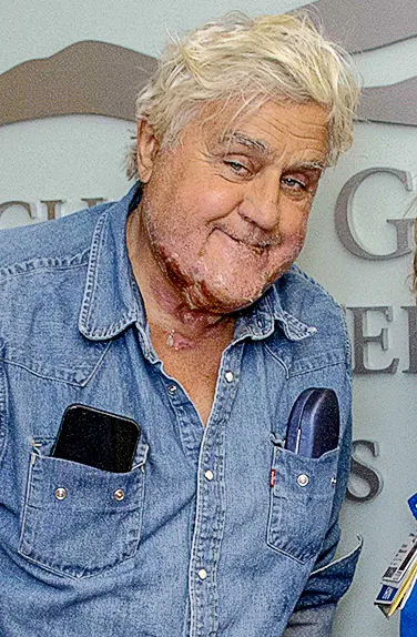 Jay Leno - Grossman Burn Center at West Hills Hospital 112