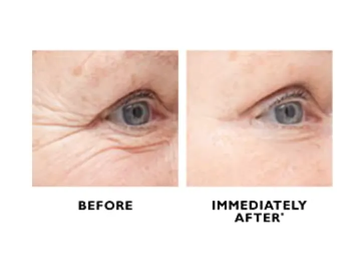 Peter Thomas Roth | Instant FIRMx Temporary Eye Tightener