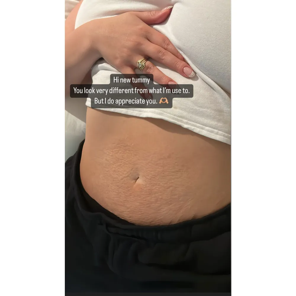 Postpartum Pic! Ashley Graham Appreciates &lsquo;New Tummy&rsquo; After Welcoming Twins