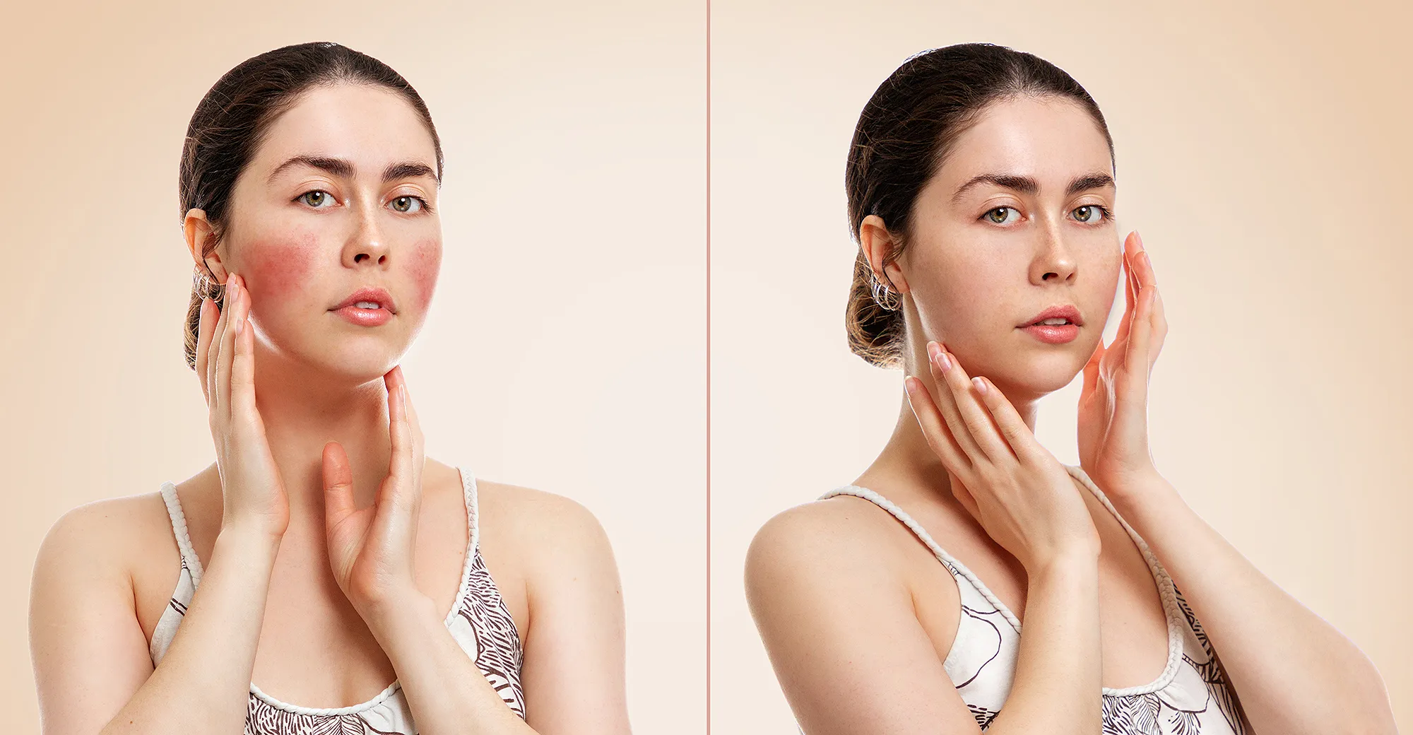 amazon-i-dew-care-matcha-mood-mask