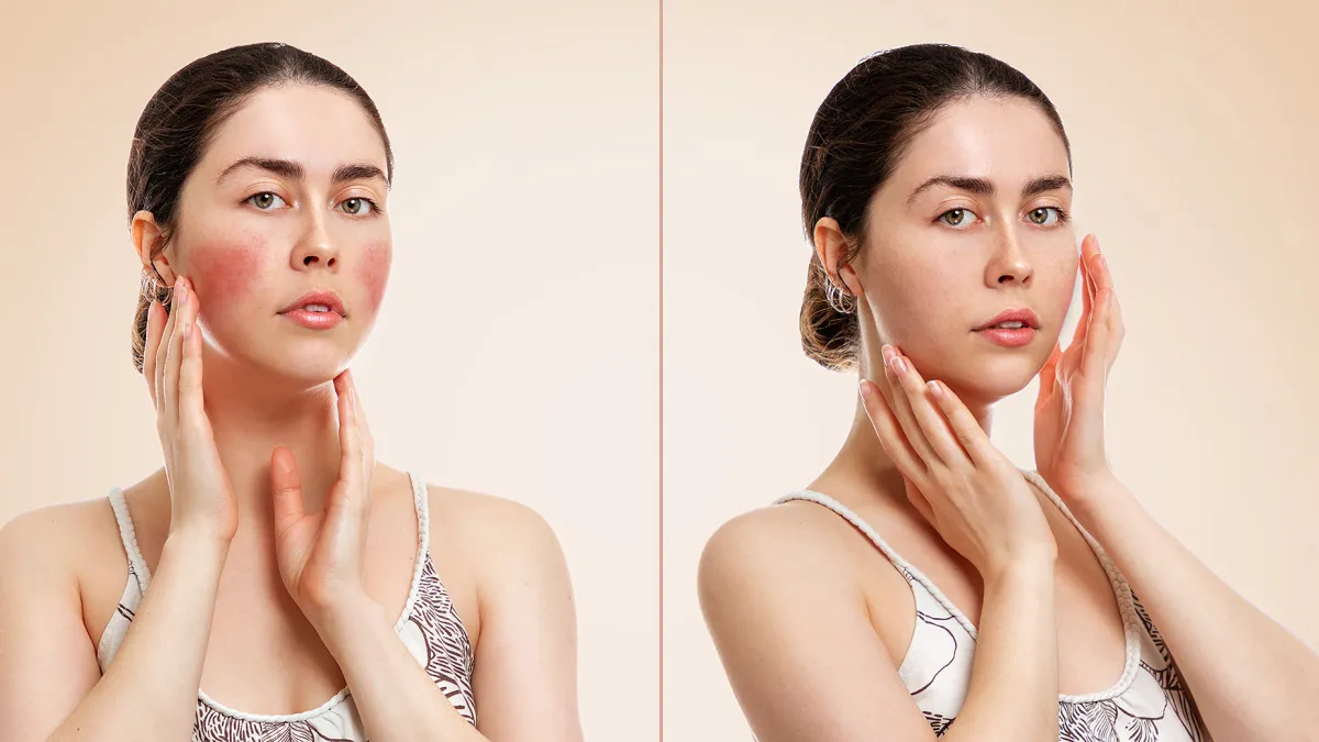 amazon-i-dew-care-matcha-mood-mask