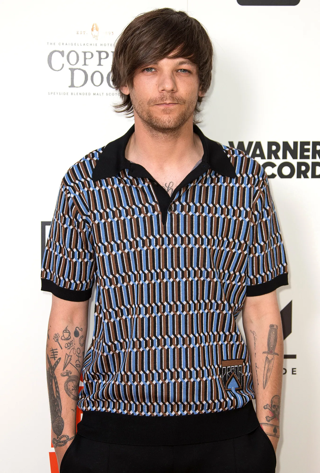 Louis Tomlinson Cancels Record Signings After Breaking Arm &lsquo;Pretty Badly&rsquo;