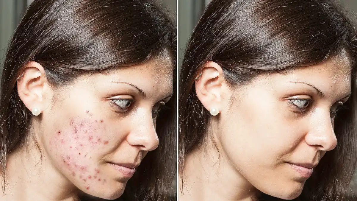 cerave-retinol-serum