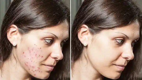 cerave-retinol-serum