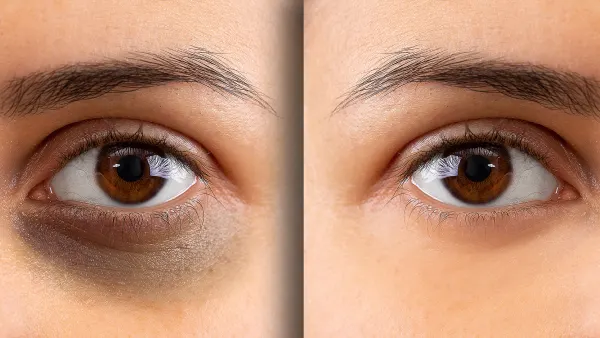 la-roche-posay-dark-circle-eye-cream