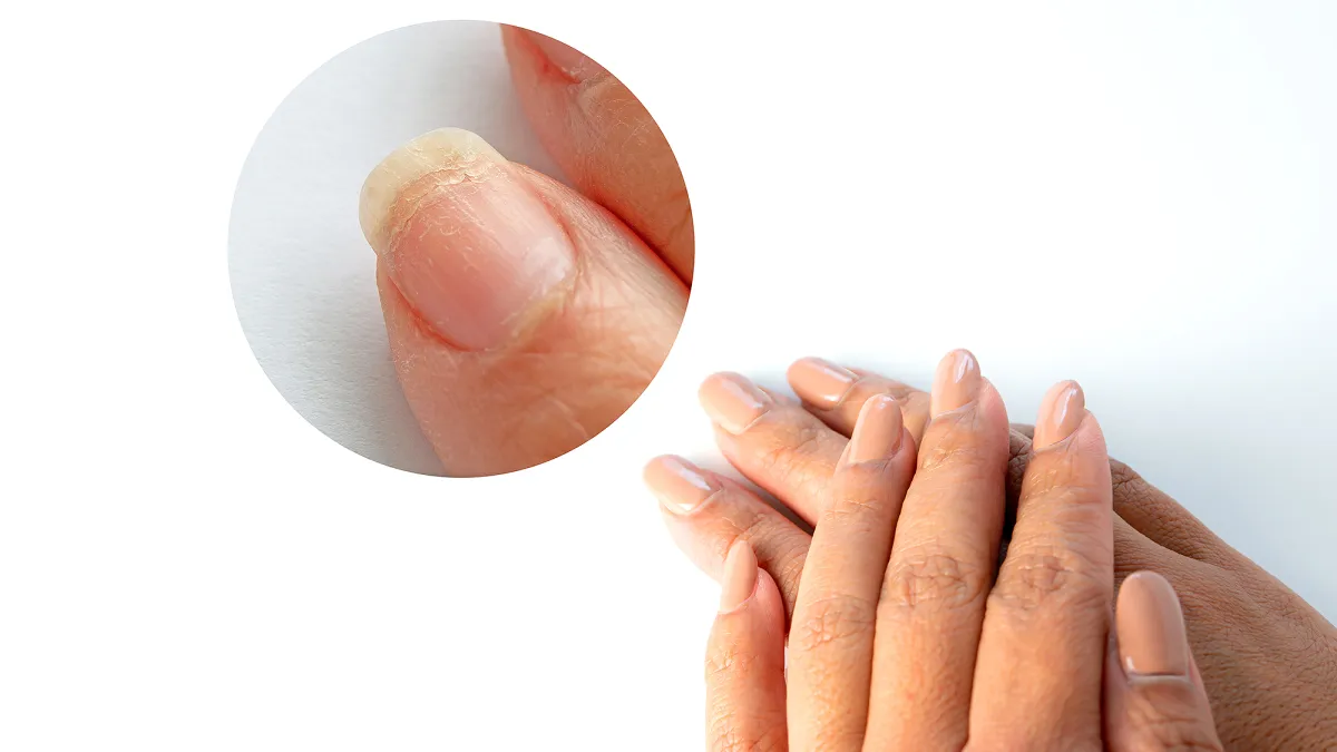 nail-cuticle-care-before-after