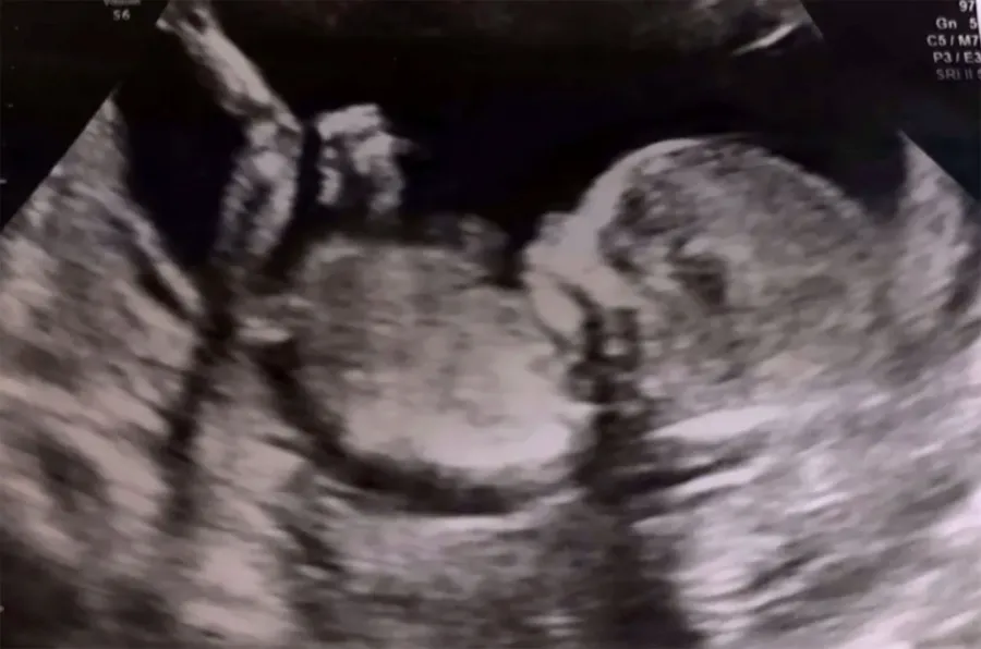 Prince Harry & Meghan BTS Personal Photos ultra sound