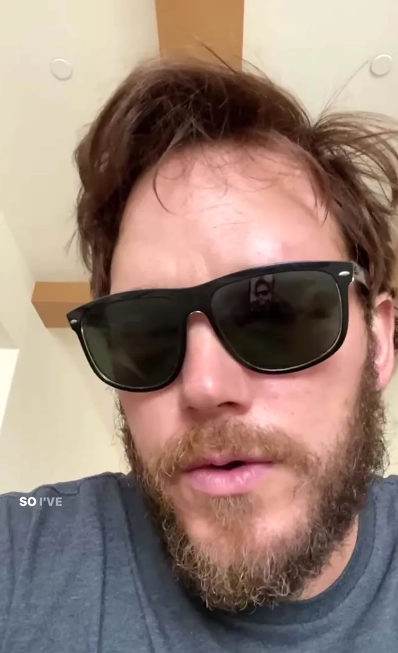 See Chris Pratt's Painful Bee Sting on His Eye After Imitating Beekeeper