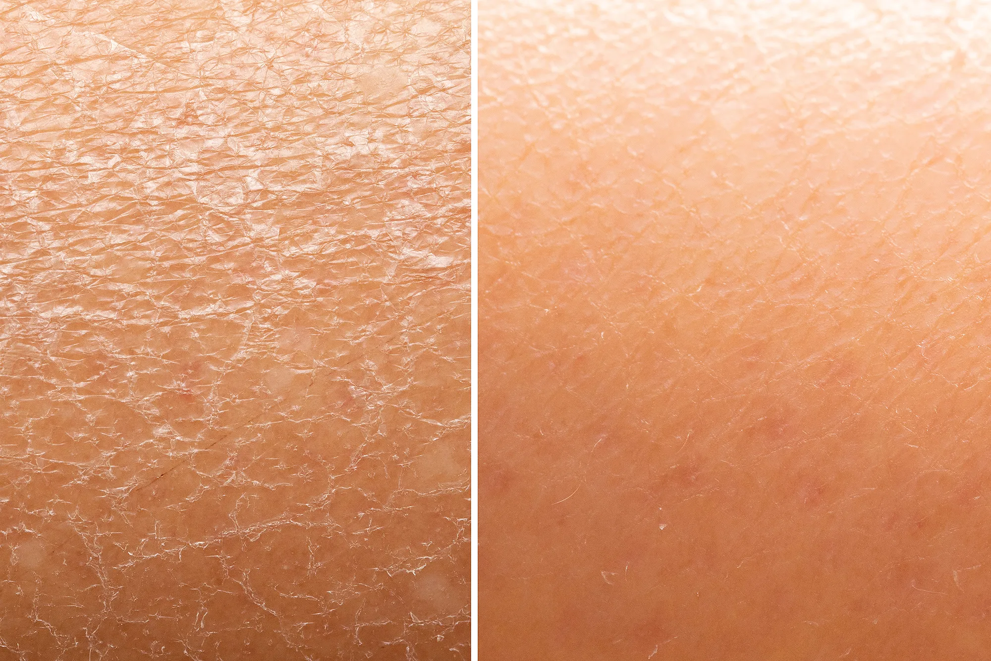 amazon-farmacy-honey-halo-moisturizer