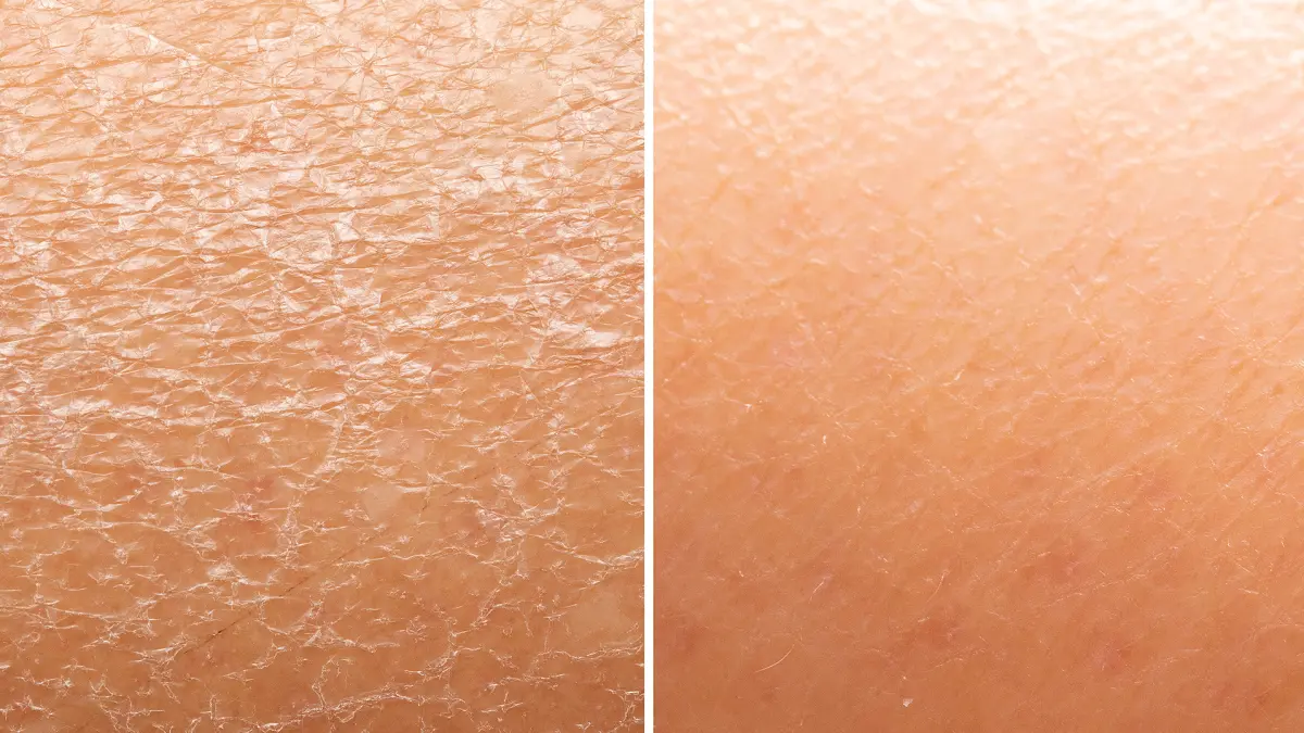 amazon-farmacy-honey-halo-moisturizer