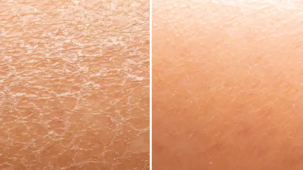 amazon-farmacy-honey-halo-moisturizer