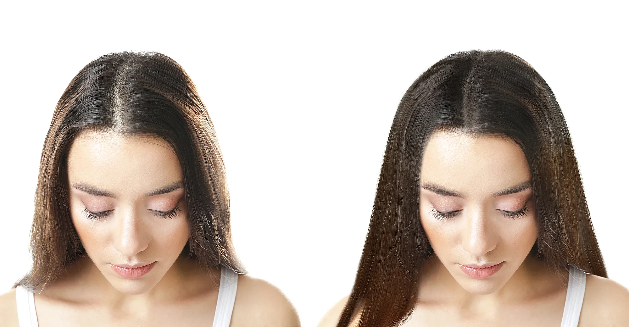 thin-hair-before-after