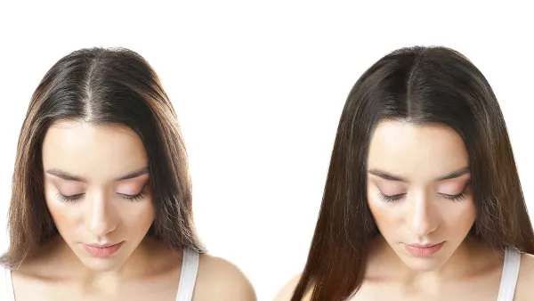 thin-hair-before-after