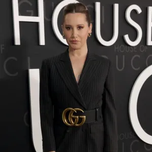 Ashley Tisdale Reveals Alopecia Diagnosis gucci belt