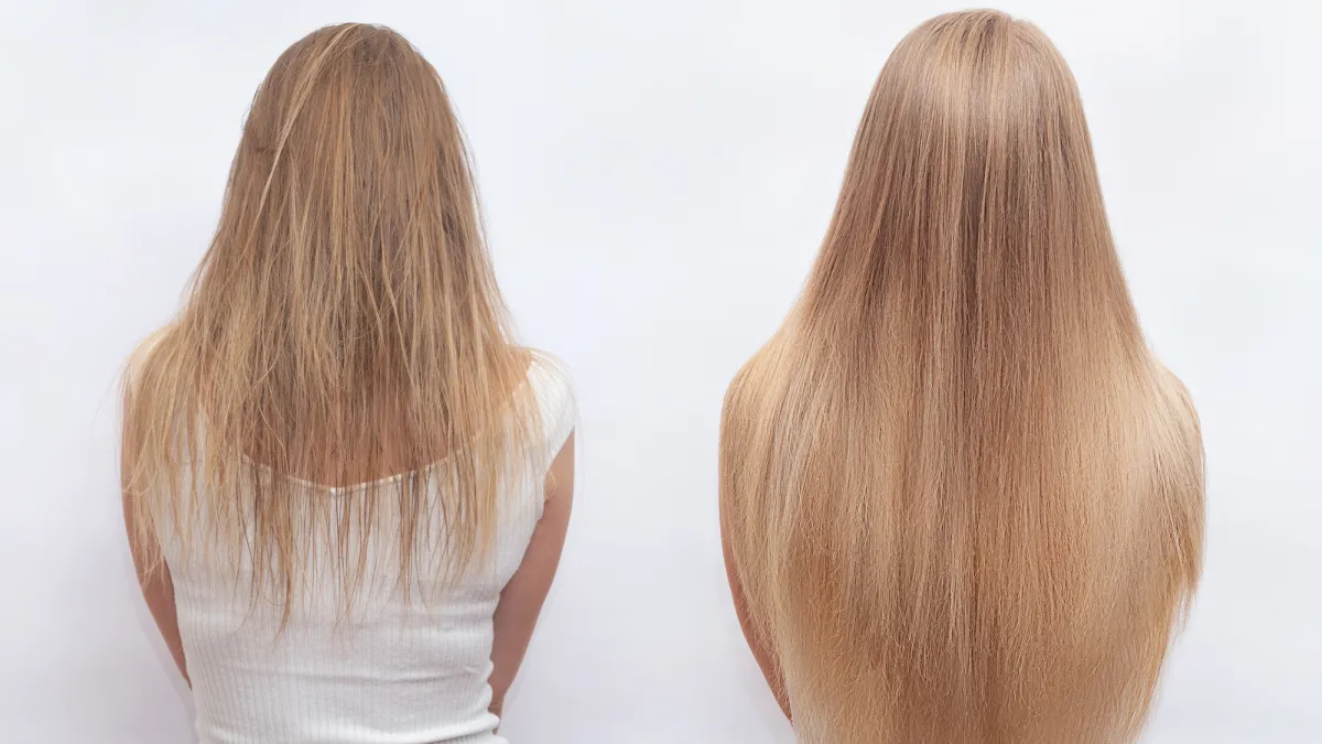 Before-After-Hair-Growth-Treatment