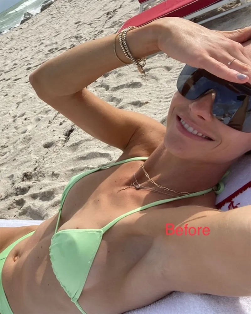 Meghan King Shares Before and After Thirst Traps After Nose and Boob Jobs 3