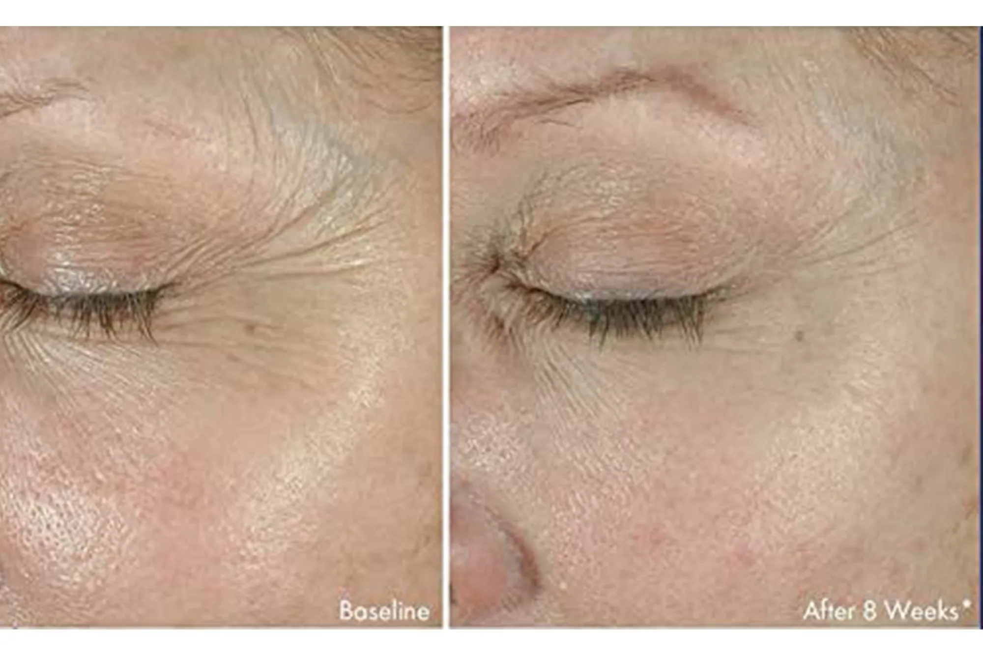 Obagi ELASTIderm Eye Cream