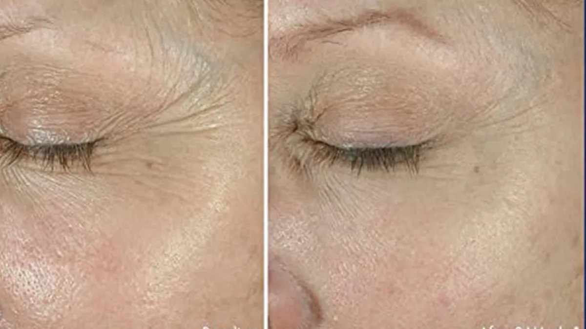 Obagi ELASTIderm Eye Cream