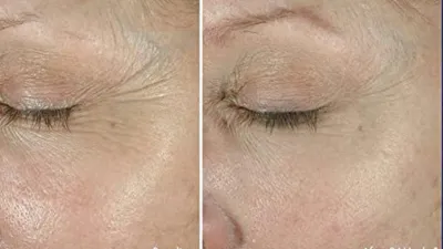 Obagi ELASTIderm Eye Cream