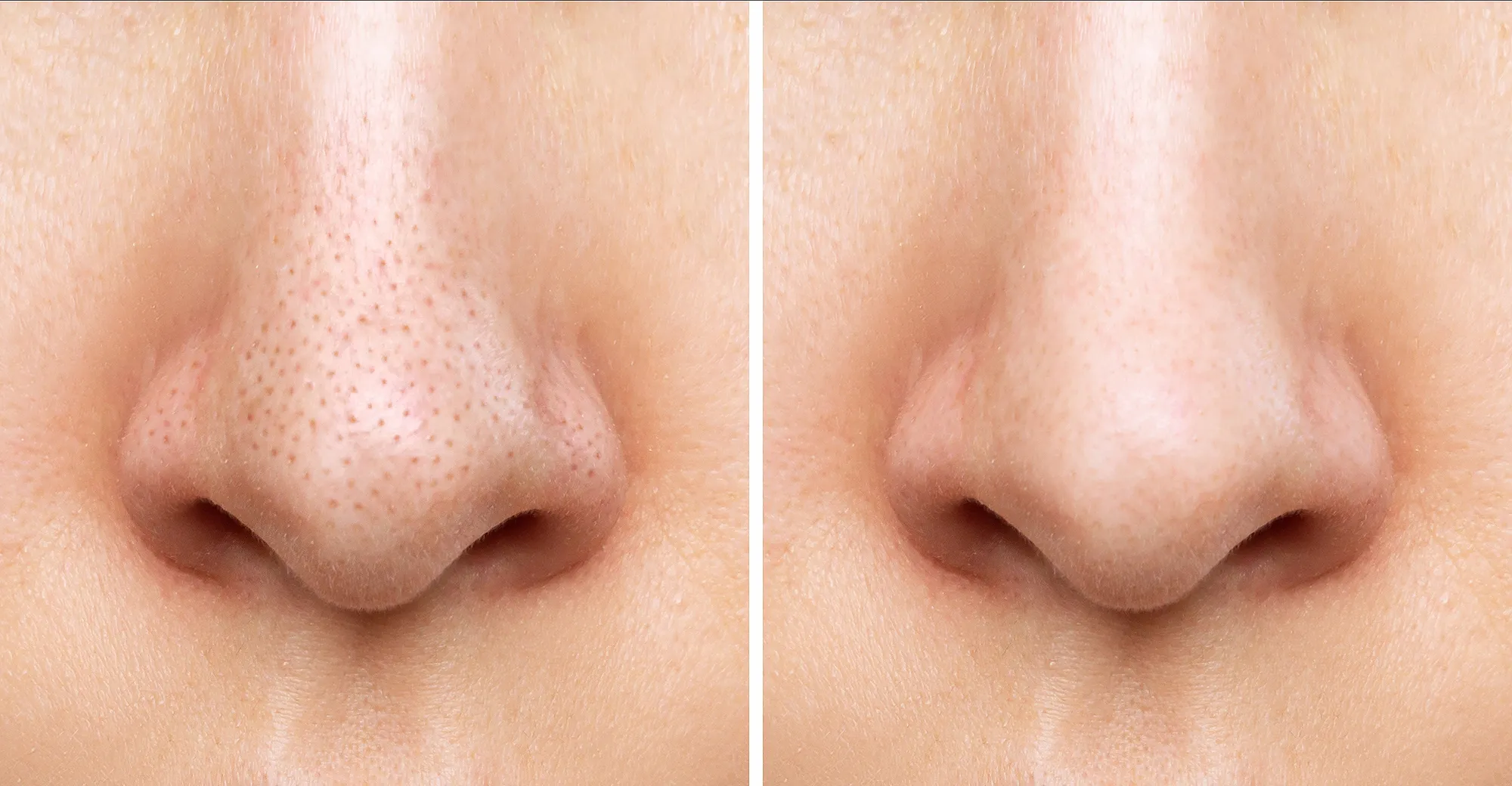 bioderma-pore-refining-cream