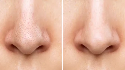 bioderma-pore-refining-cream