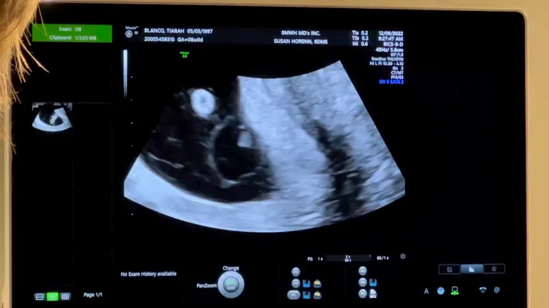 Brody Jenner and Girlfriend Tia Blanco Expecting 1st Baby: 'The Blessing of a New Life'