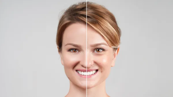 skin before and after