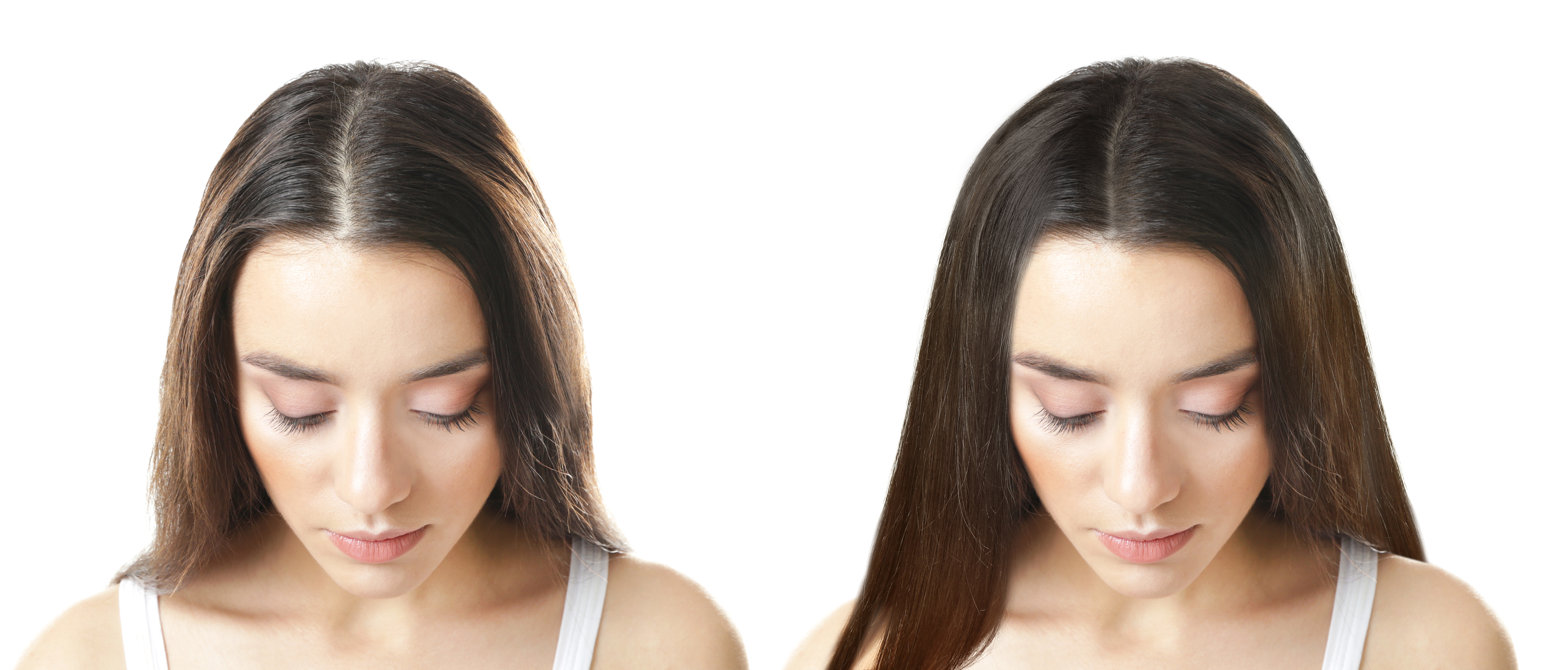 hair growth treatments