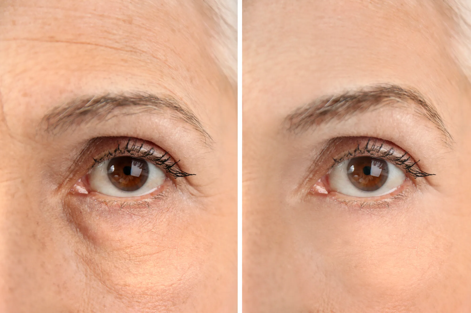 Before-After-Eye-Serum-Stock-Photo