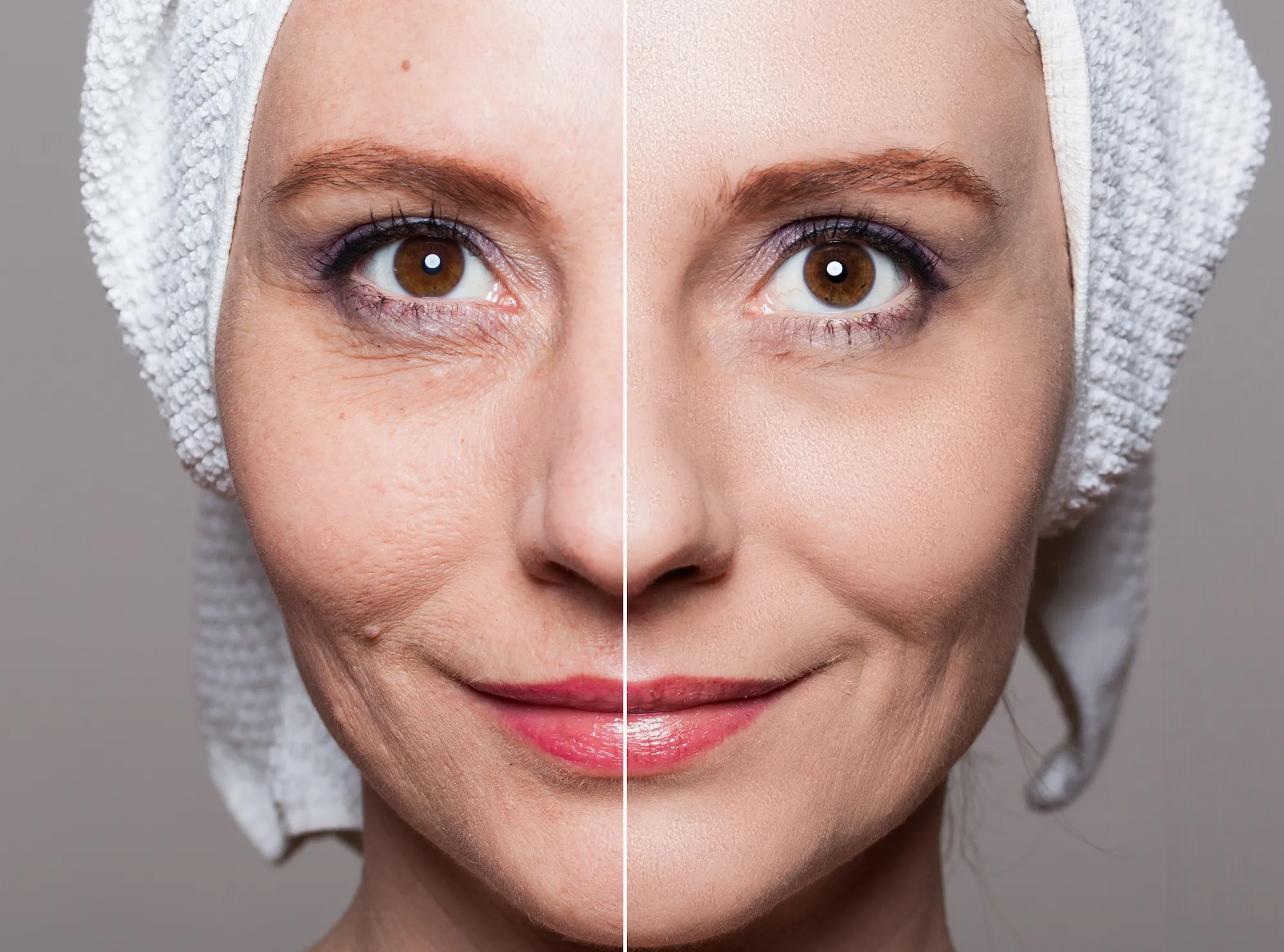 Before-After-Facial-Treatment-Stock-Photo