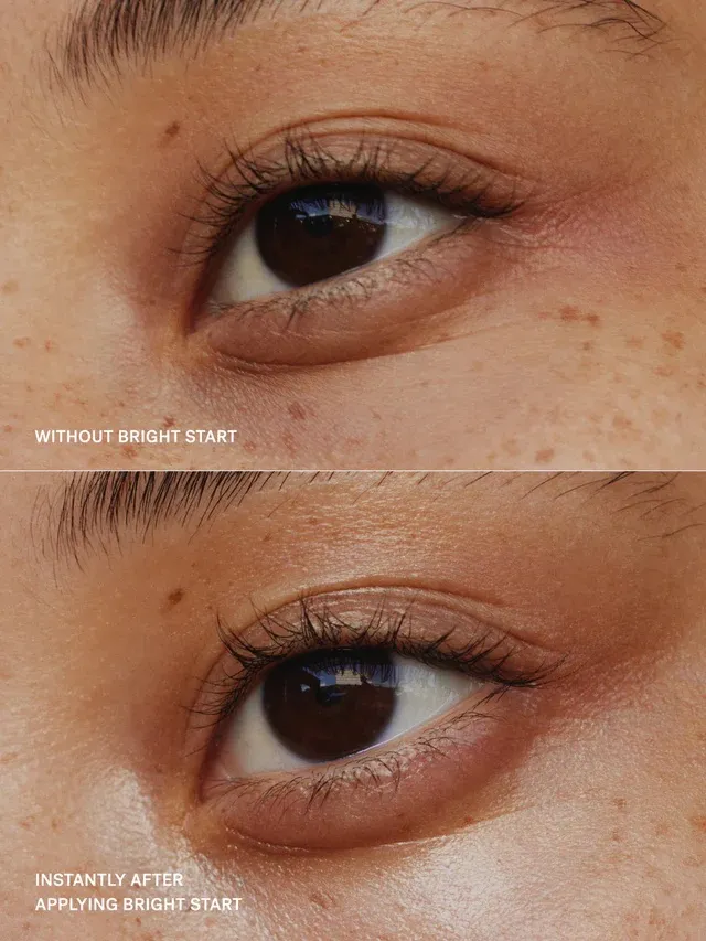 Bright Start Retinol Alternative Eye Cream