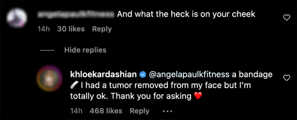 Khloe Kardashian Claps Back at Comment About Band-Aid After Undergoing Surgery to Remove Facial Tumor