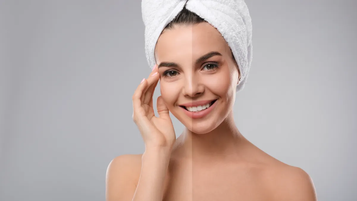 Tanned-Skin-Before-After