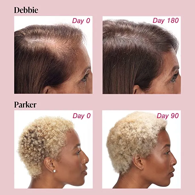 Viviscal Hair Growth Supplement