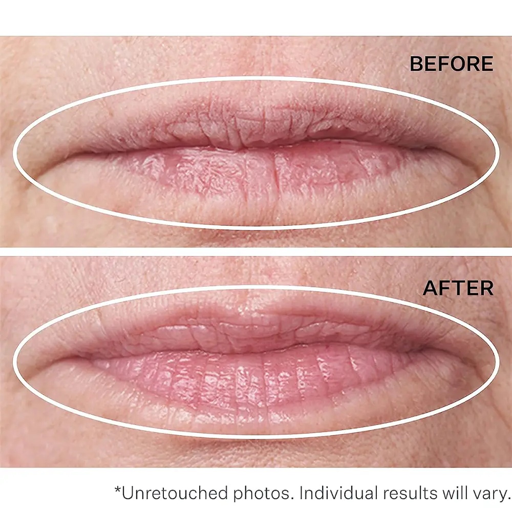 amazon-strivectin-anti-wrinkle-lip-treatment