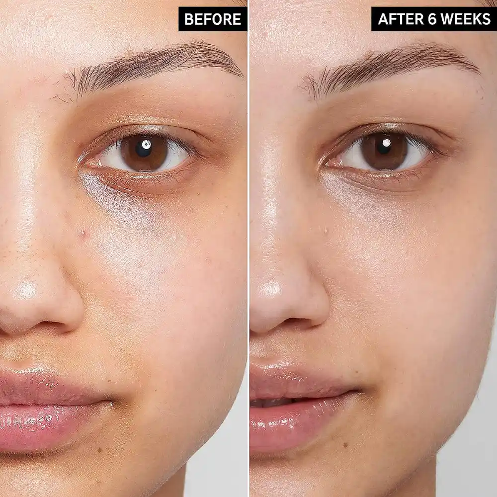 amazon-the-inkey-list-caffeine-eye-cream-before-after