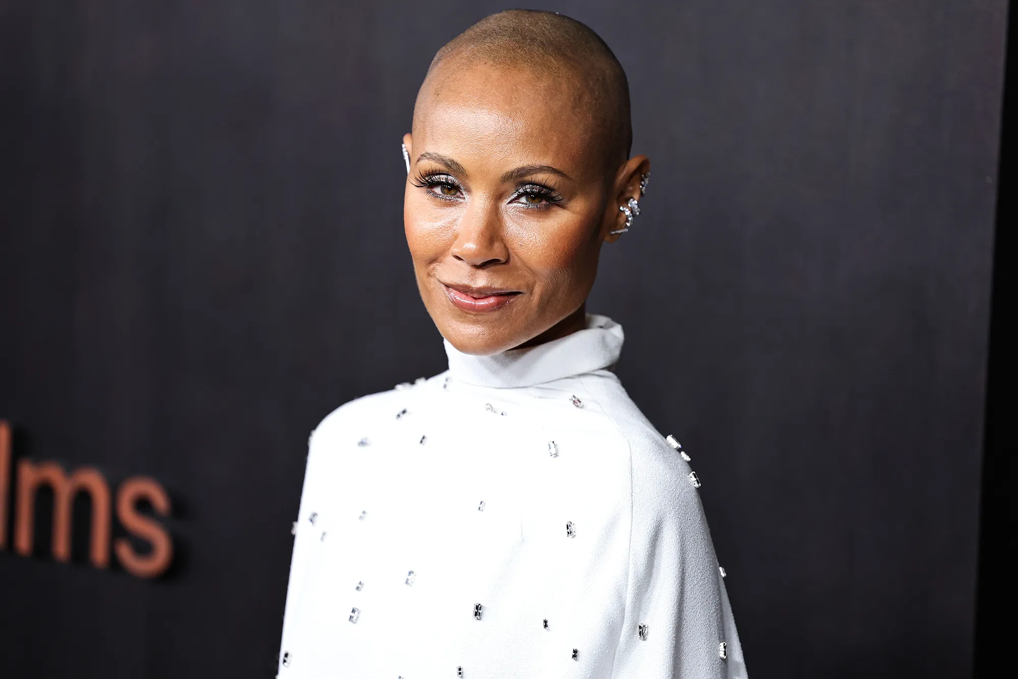 Jada Pinkett Smith: Alopecia Taught Me About &lsquo;Detachment,&rsquo;&lsquo;Deeper Beauty&rsquo;