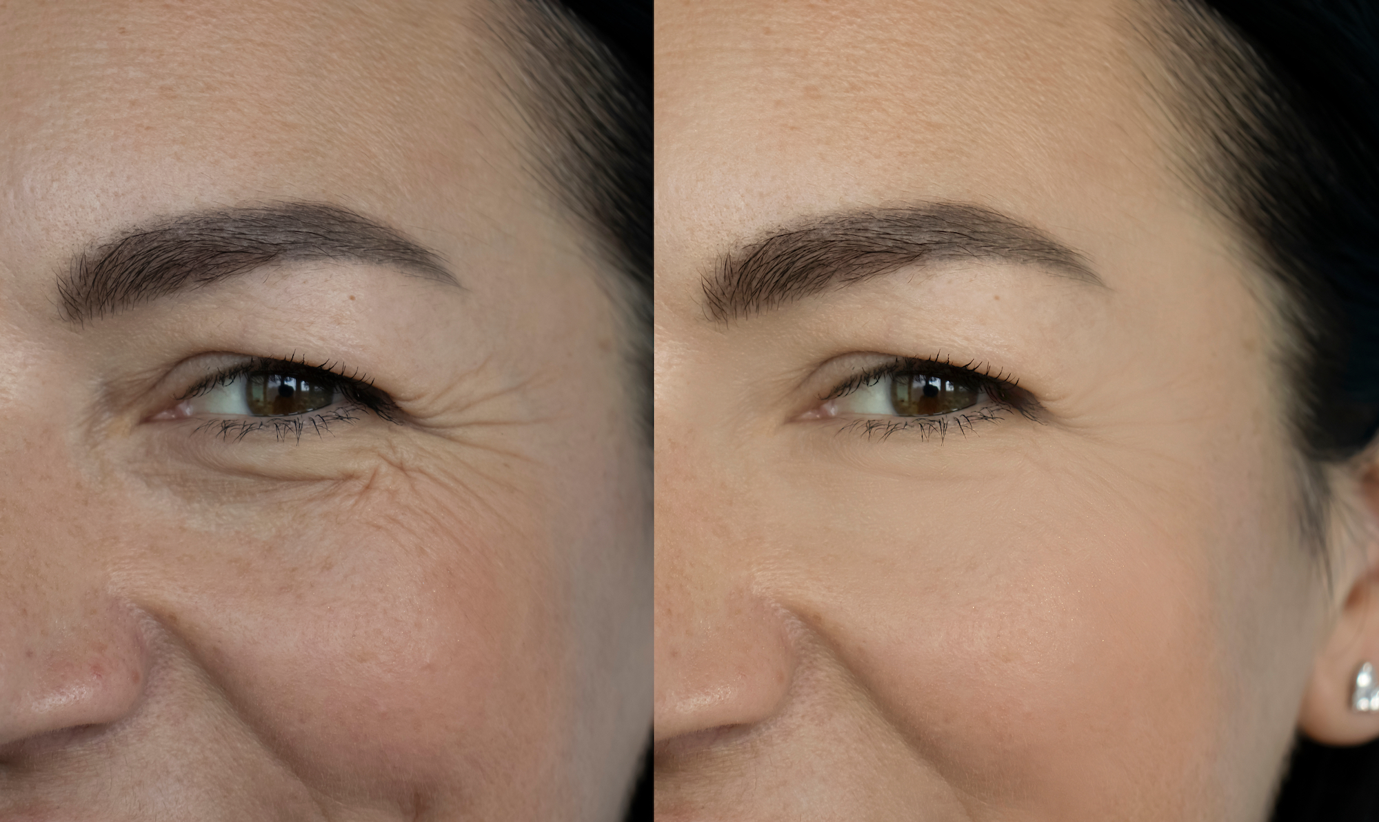 Before-After-Wrinkle-Closeup-Shot-Stock-Photo