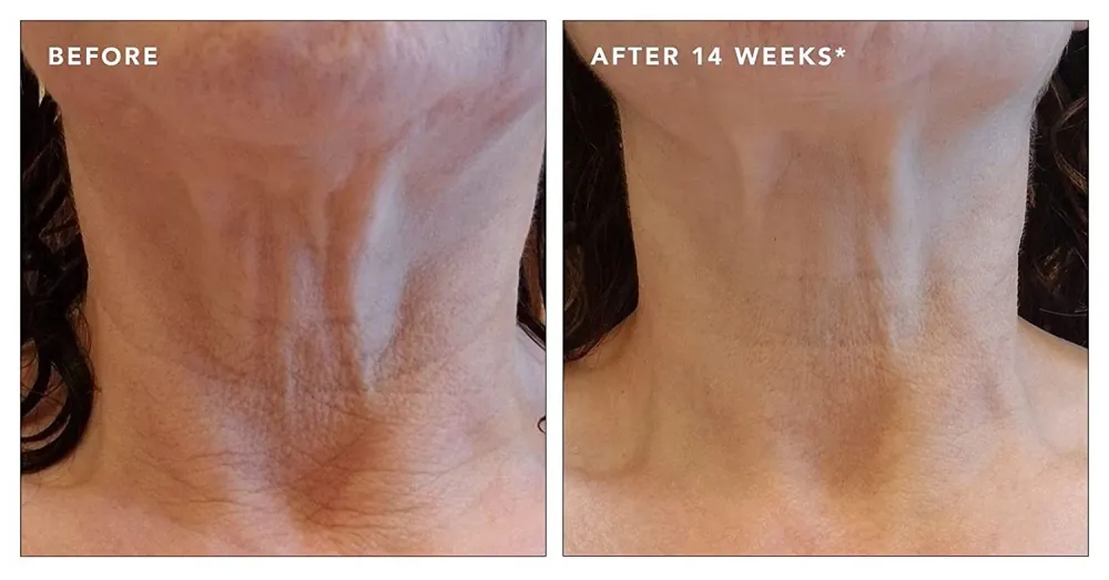 Revision Skincare Nectifirm Advanced Neck Firming Cream