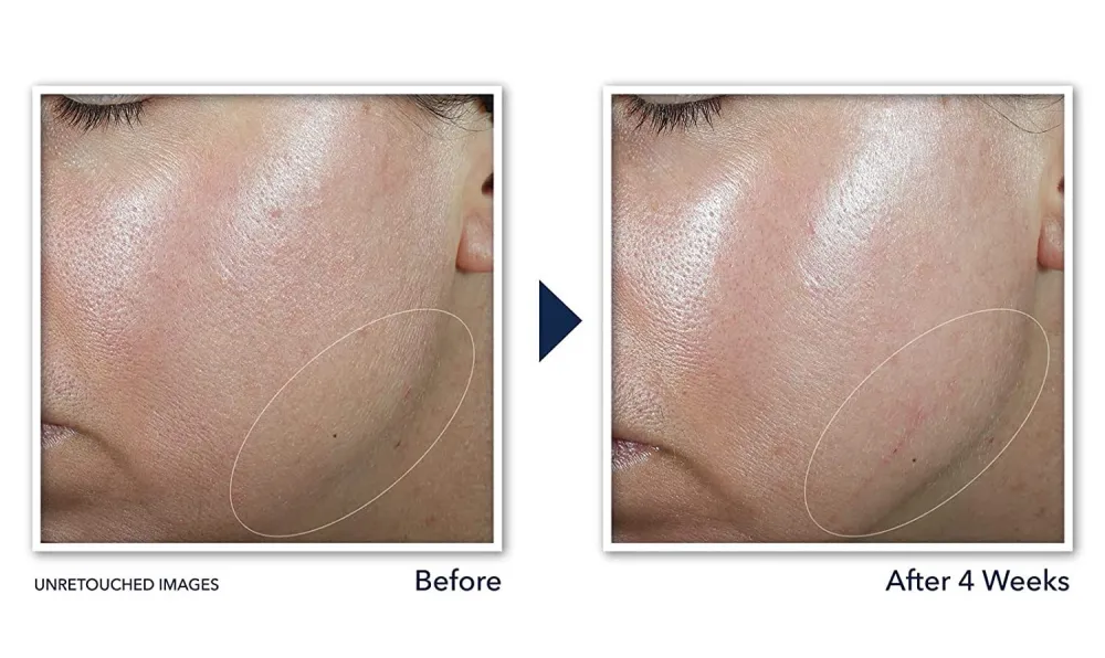 RoC Derm Correxion Neck Cream