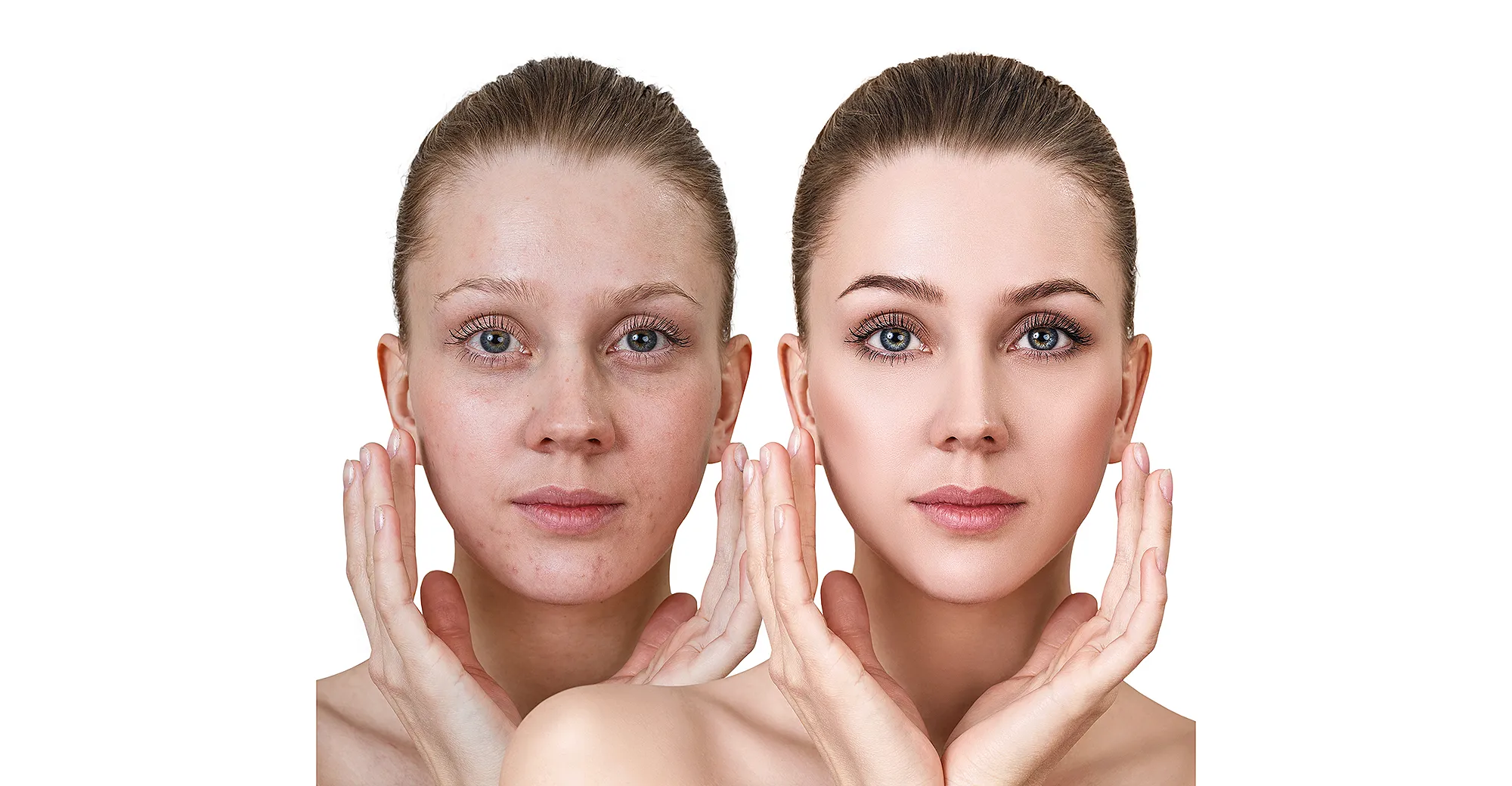 amazon-beauty-innisfree-retinol-serum