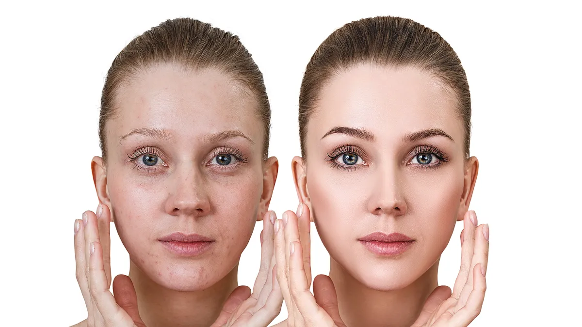 amazon-beauty-innisfree-retinol-serum