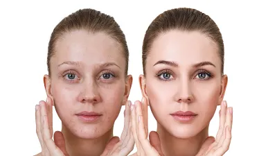 amazon-beauty-innisfree-retinol-serum