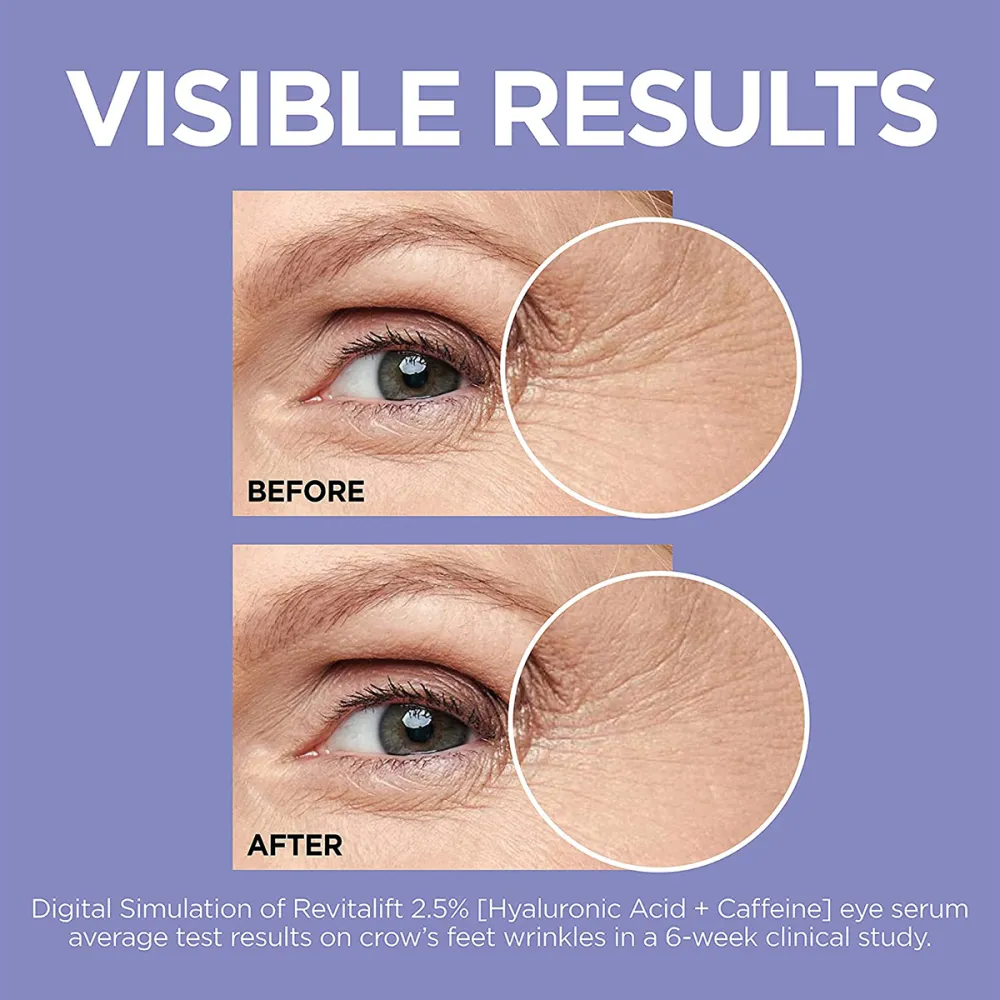 loreal-eye-serum-results
