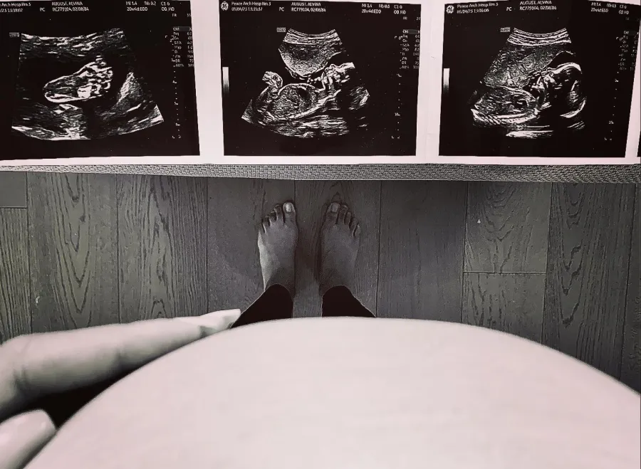 2023 Celebrity Pregnancies Marco Grazzini and Alvina August