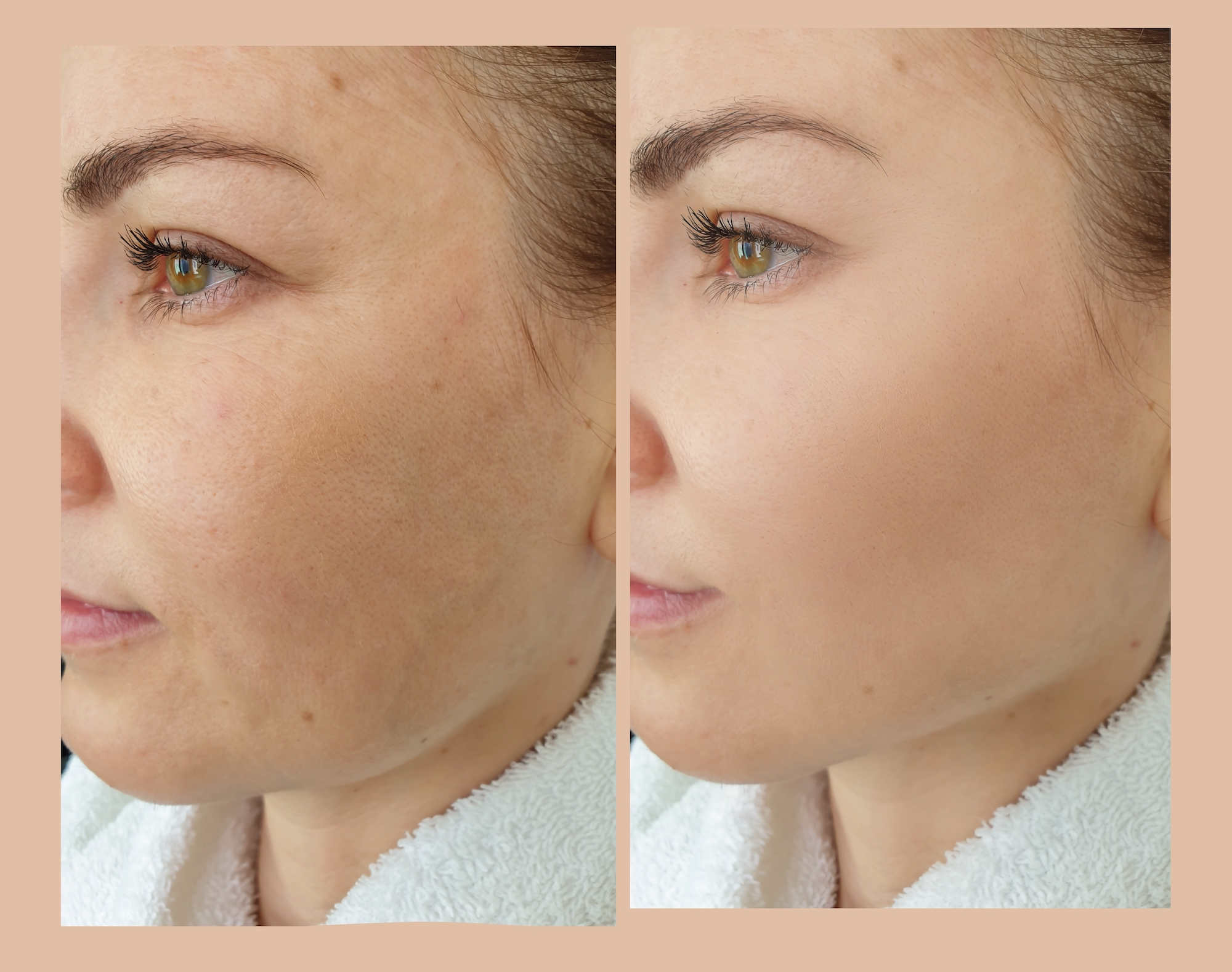 Before-After-Facial-Treatment-Stock-Photo